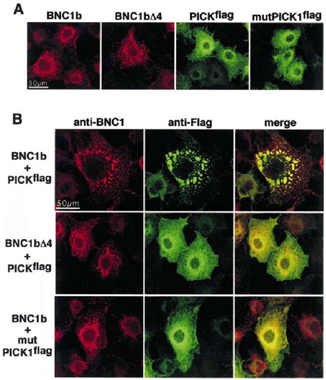 PICK1 Alters The Distribution Of BNC1b Via Its PDZ Domain In COS 7