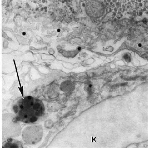 Transmission Electron Autoradiomicrograph TEAM Of Rat Liver At Day I