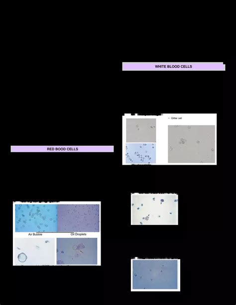 Urinalysis And Other Body Fluids Microscopic Urine Analysis College