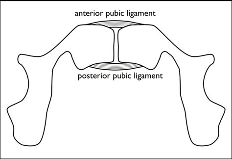 Figure 2 From Postpartum Symphysis Pubis Diastasis Semantic Scholar