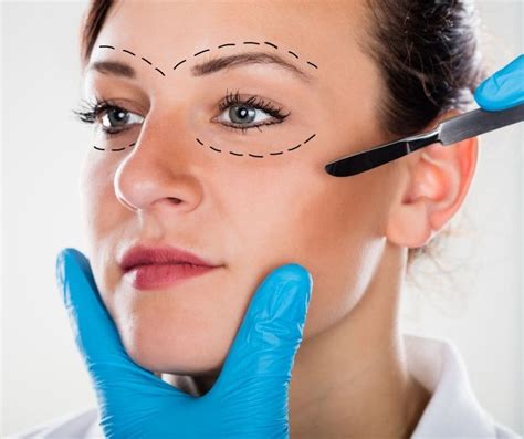 The Ultimate Guide To Eyelid Lift Surgery Blepharoplasty What You Need To Know