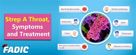 Strep A Throat Symptoms And Treatment Important Facts