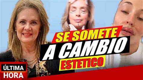 SE SOMETE A CAMBIO ESTETICO A ESTO se SOMETERÁ Érika Buenfil YouTube