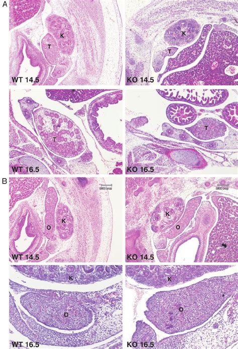 Histology Of Testes And Ovaries At Two Stages Of Embryonic Development