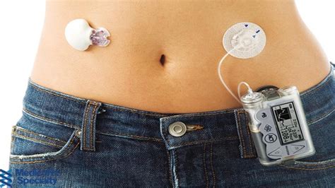 Benefits of Insulin Patch Therapy - Duysnews.com