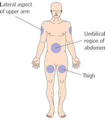 Sites Of Subcutaneous Injection And Complications, 50% OFF