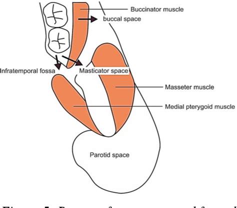 Figure 1 From Atlas Of Otolaryngology Head And Neck Operative Surgery