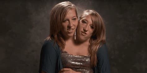 The Story Of Elementary School Teachers Conjoined Twins Abby And Brittany