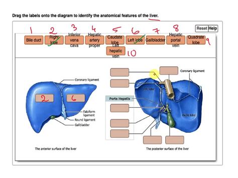 Solved Draw The Inferior Side Of The Liver Showing The Lobes And