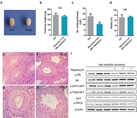 Rapamycin Mediated Mtor Inhibition Impairs Silencing Of Sex Chromosomes