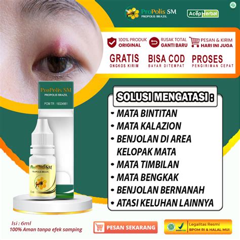 Jual Obat Oles Mata Bintitan Kalazion Mata Timbilan Bernanah Mata