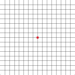 Amsler Grid At-Home Retinal Vision Test - Retinal Eye Care