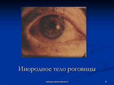 Обзорная лекция кафедра офтальмологии 1 Глазное дно