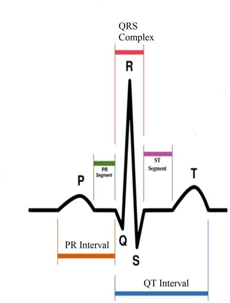 A typical ECG Waveform | Download Scientific Diagram