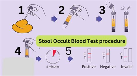 Stool Occult Blood Test Procedure Step By Step In Lab