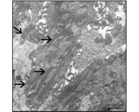 Electron microscopic image showing continuous basal lamina (BL) and ...