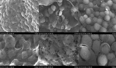 Scanning electron microscopy for particles with immobilized yeast ... 