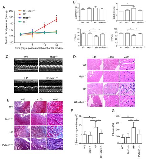 Mst1 Silencing Alleviates Hypertensive Myocardial Injury Associated