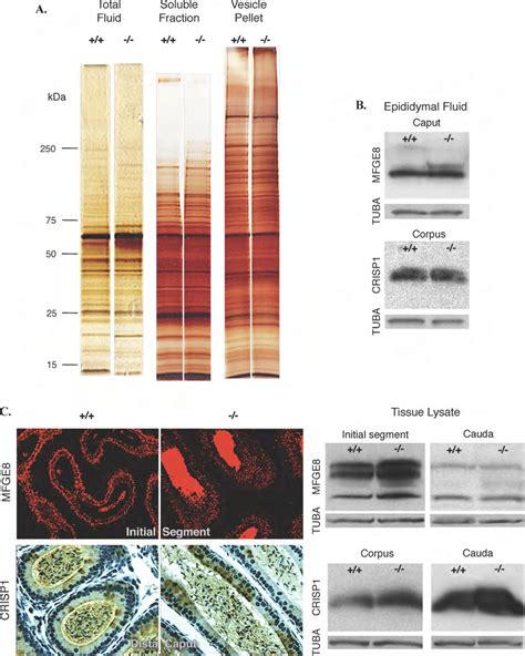 Many Epididymal Proteins Are Expressed And Localized Normally In The