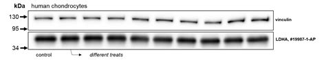 Ldha Specific Antibody Ap Proteintech