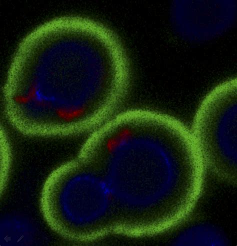 Identification Of Hexose Transporter Like Sensor Hxs And Functional