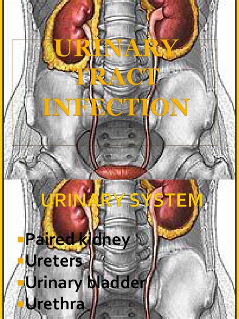 PDF Urinary Track Infection DOKUMEN TIPS