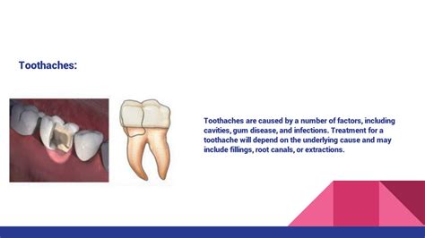 Ppt Common Dental Problems And Their Treatments Powerpoint