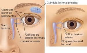 Obstru O Do Canal Lacrimal Fernando Bragan A Pediatria E Homeopatia