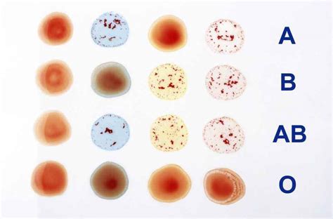 The Basics of Blood Grouping | Healthtian