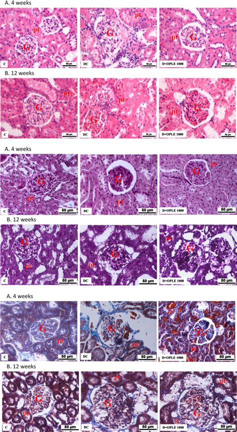 Effect Of OPLE On Renal Morphology Histological Sections Of Kidneys