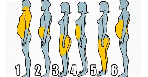 Salud Y Mentalidad Nueva Hay 6 Tipos De Obesidad ¡mira Cuál Es El Tuyo Y Elimínalo