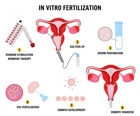 Premium Vector In Vitro Fertilization Composition With Sperm