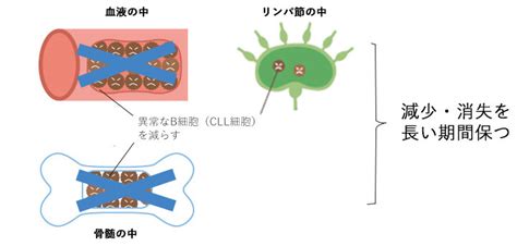 慢性リンパ性白血病（cll）の治療の基本的な考え方と治療目標｜ Cllライフ