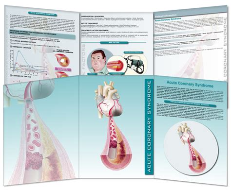 Acute Coronary Syndrome Signs And Symptoms