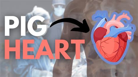 The First Successful Pig Heart Transplant Youtube