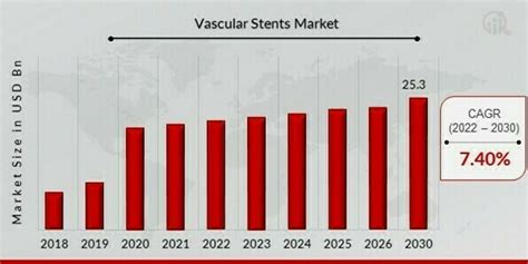 Vascular Stents Market Size Growth Analysis Trends