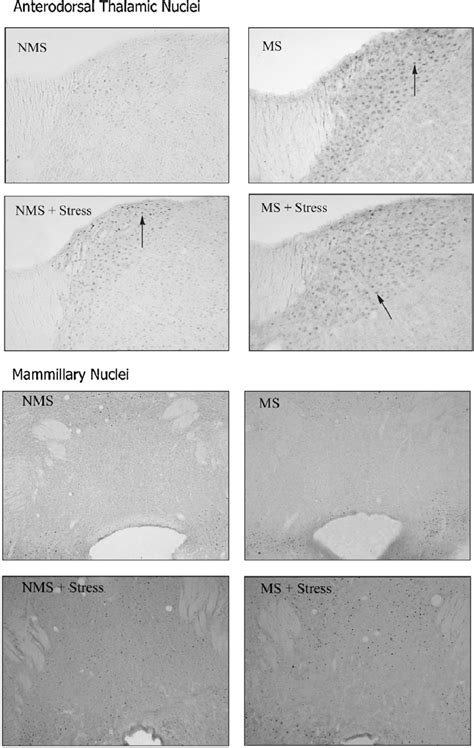 Representative Photomicrographs Showing Fos Immunoreactivity The Upper