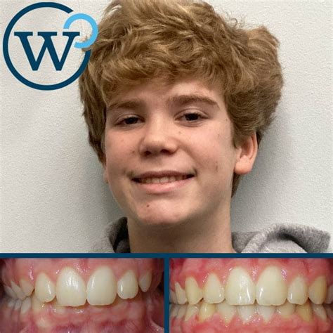 Charlotte Nc Orthodontists 1