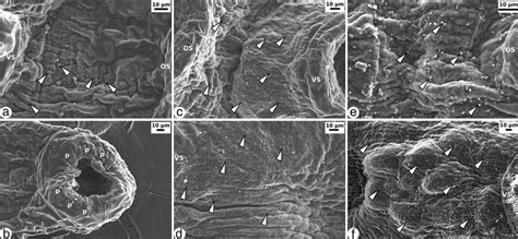 Scanning Electron Microscopy Of The Different Tegumental Regions Of Download Scientific Diagram