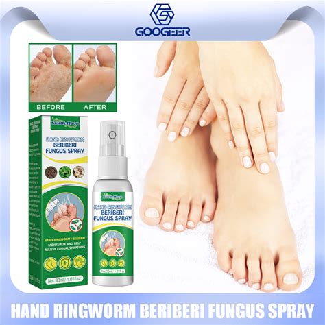 South Moon Foot Fungus Treatment Spray Anti Beriberi Infection Itch