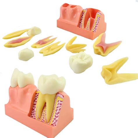 Buy Teeth Anatomical Models 4 Times Magnification Tooth Decomposition