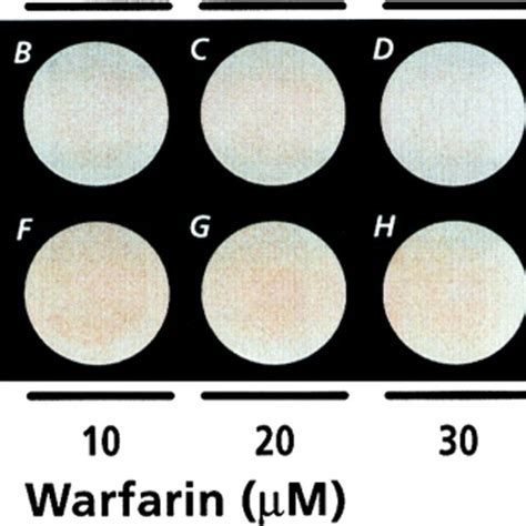 Ft Ir Analysis Of Mineral Confluent Hypertrophic Chondrocyte Cultures