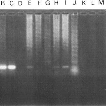 An Ethidium Bromide Stained Agarose Gel Electrophoresis Lane A