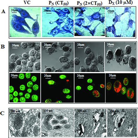 Representative Photomicrographs Of Morphology Of HeLa Cells Stained