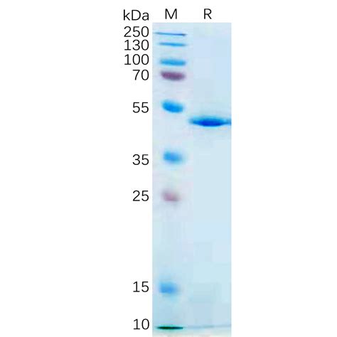 Human IL21 Protein hFc Tag 专注肿瘤免疫