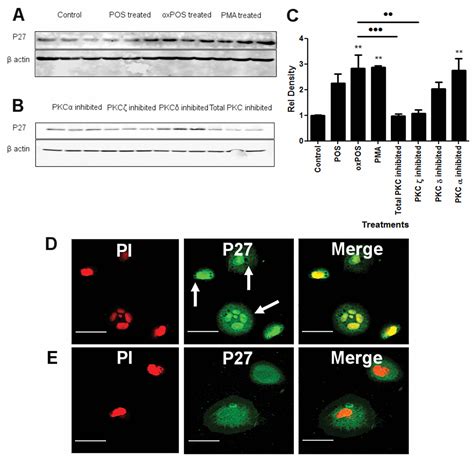 Pkc Dependent Upregulation Of P Kip Contributes To Oxidative Stress