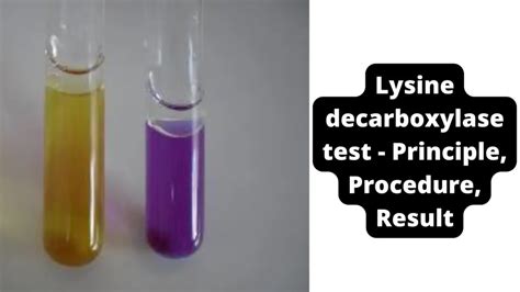 Lysine Decarboxylase Test Principle Procedure Result Biology