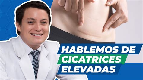 Tratamiento Para Cicatrices Hipertróficas Y Queloides Clínica Vásquez