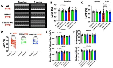 Antioxidants Free Full Text CaMKII Dependent Contractile