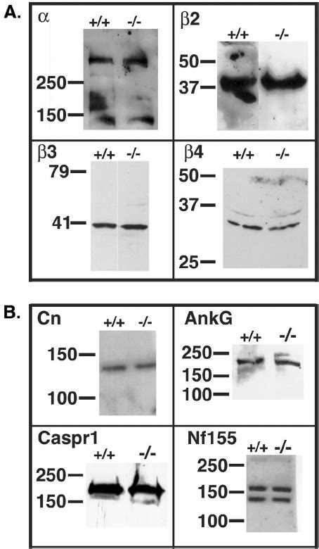 Western Blot Analysis Of Brain Membranes From ␤ 1 Ϫ Ϫ Mice A